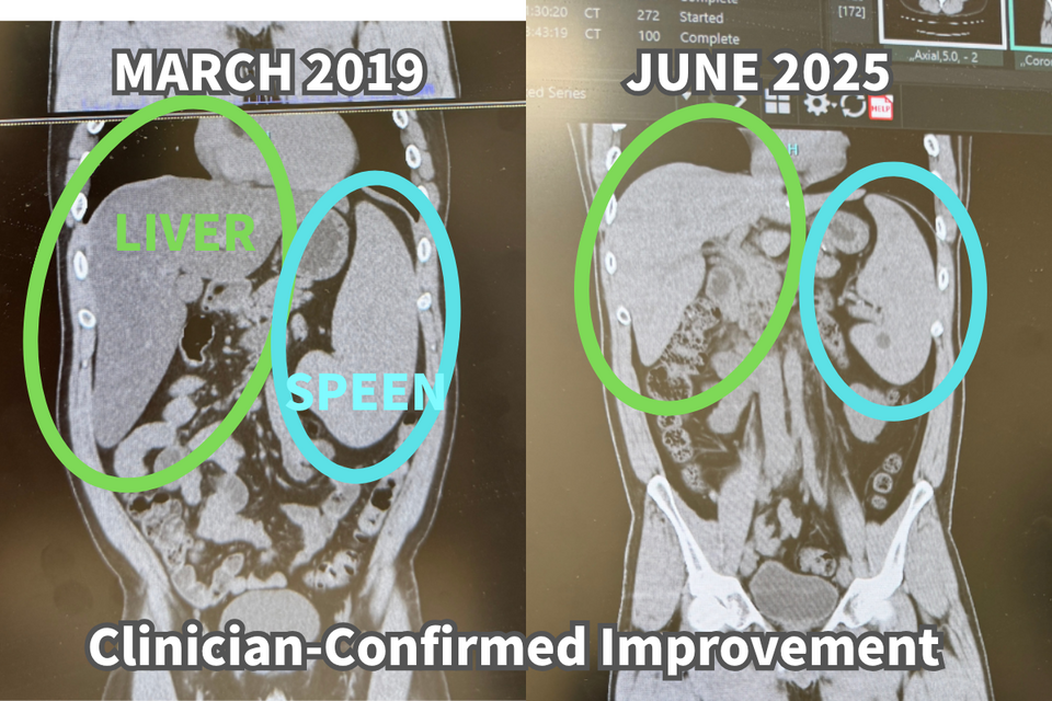 Anonymised CT scan comparison from 2019 and 2025